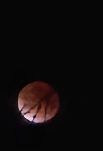 stony, man. 400 clumsy, distracted, cottonmouth